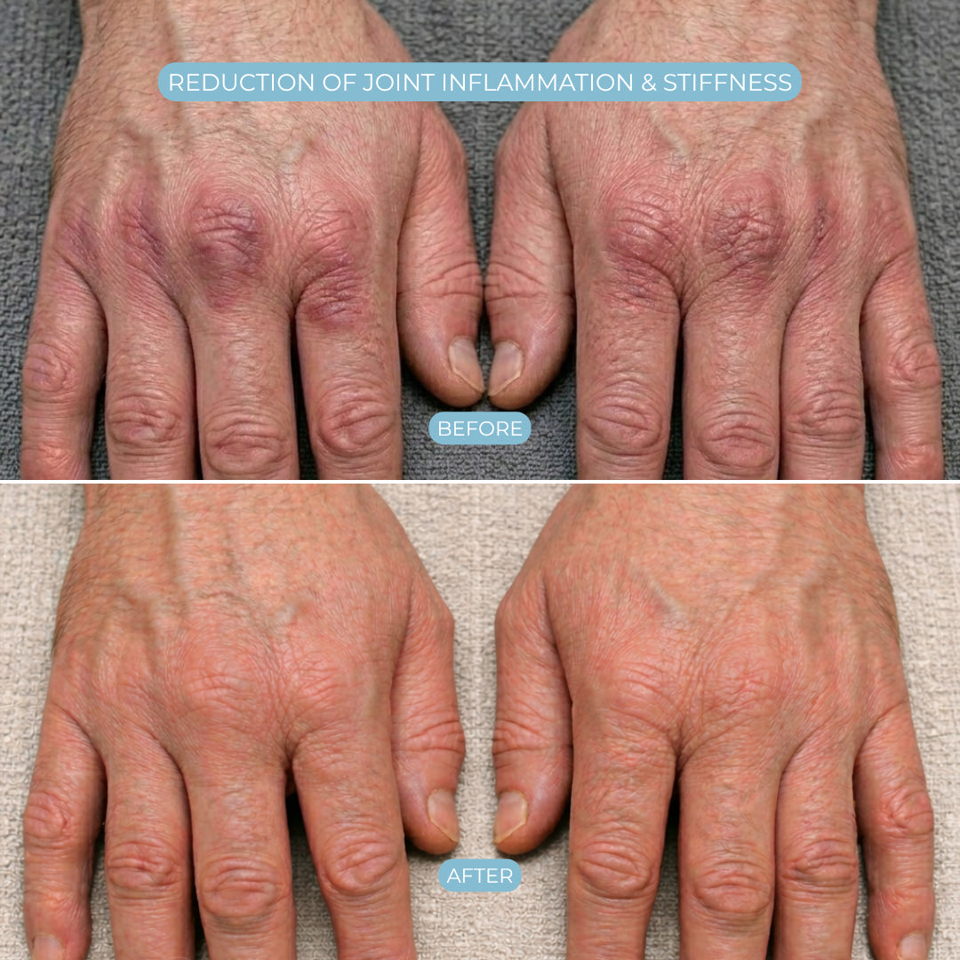 HandCure® Therapeutic Glove for Hand Pain Relief