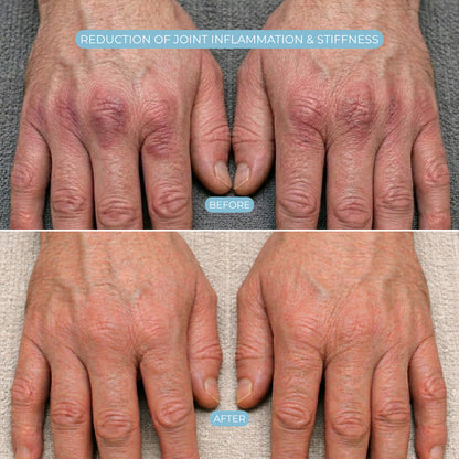 HandCure® Therapeutic Glove for Hand Pain Relief