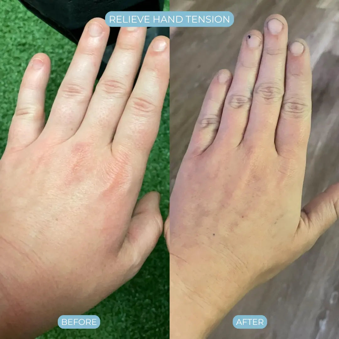 HandCure® Therapeutic Glove for Hand Pain Relief